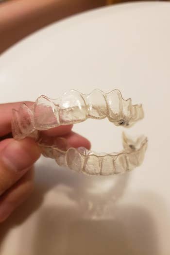 The same Invisalign looking significantly cleaner