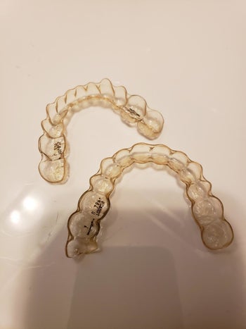 Reviewer's Invisalign, which behold somewhat yellow