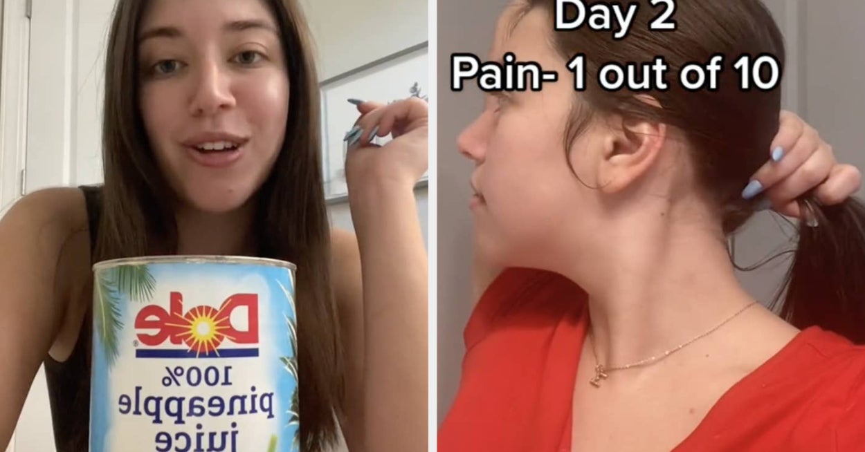 Pineapple Juice For Wisdom Teeth Removal Pain On TikTok