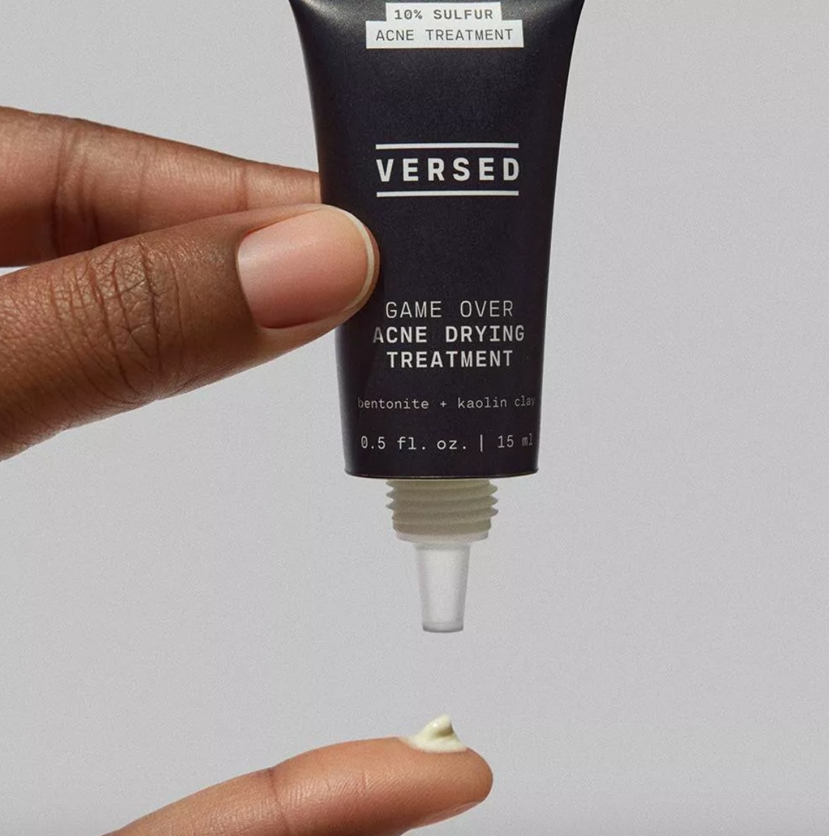 model squeezing versed acne treatment on finger