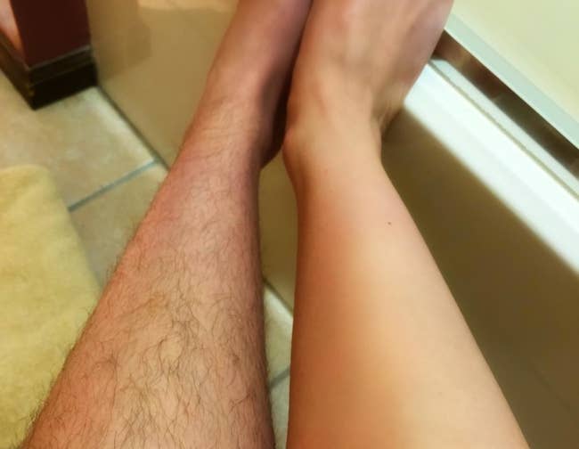 a reviewer photo of one leg covered with hair and the other hair-free
