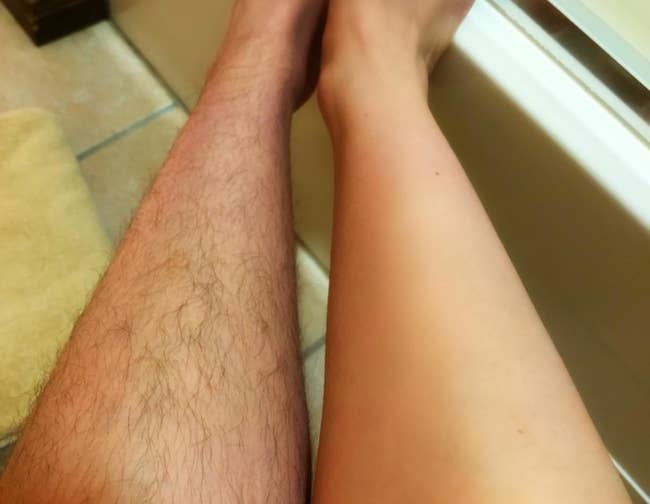 a reviewer photo of one leg covered with hair and the other hair-free