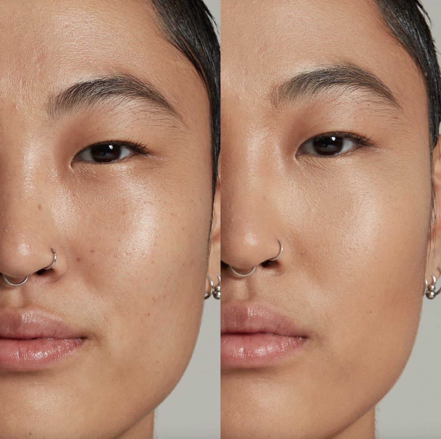 A woman showing her face before and after using concealer