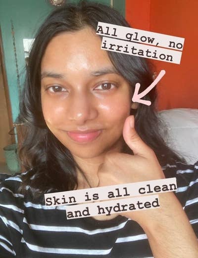 The same BuzzFeed writer showing off her clean and glowy skin after using the cleansing balm