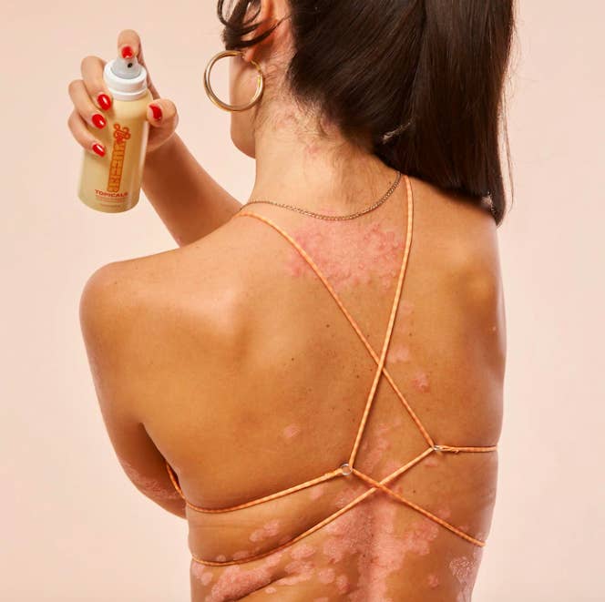A person spritzing the lotion mist onto their back