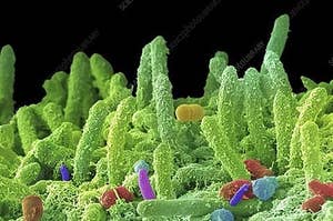 Oral bacteria STEVE GSCHMEISSNER Creative Commons Attribution-Share Alike 4.0 via Wikimedia Commons