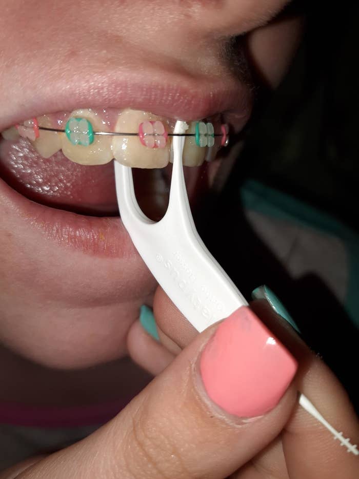 person using the pic to fit under wire in between braces on front teeth