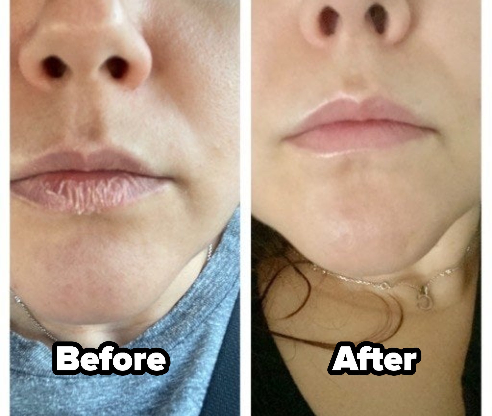 a split image of a reviewer&#x27;s lips before and after using the balm