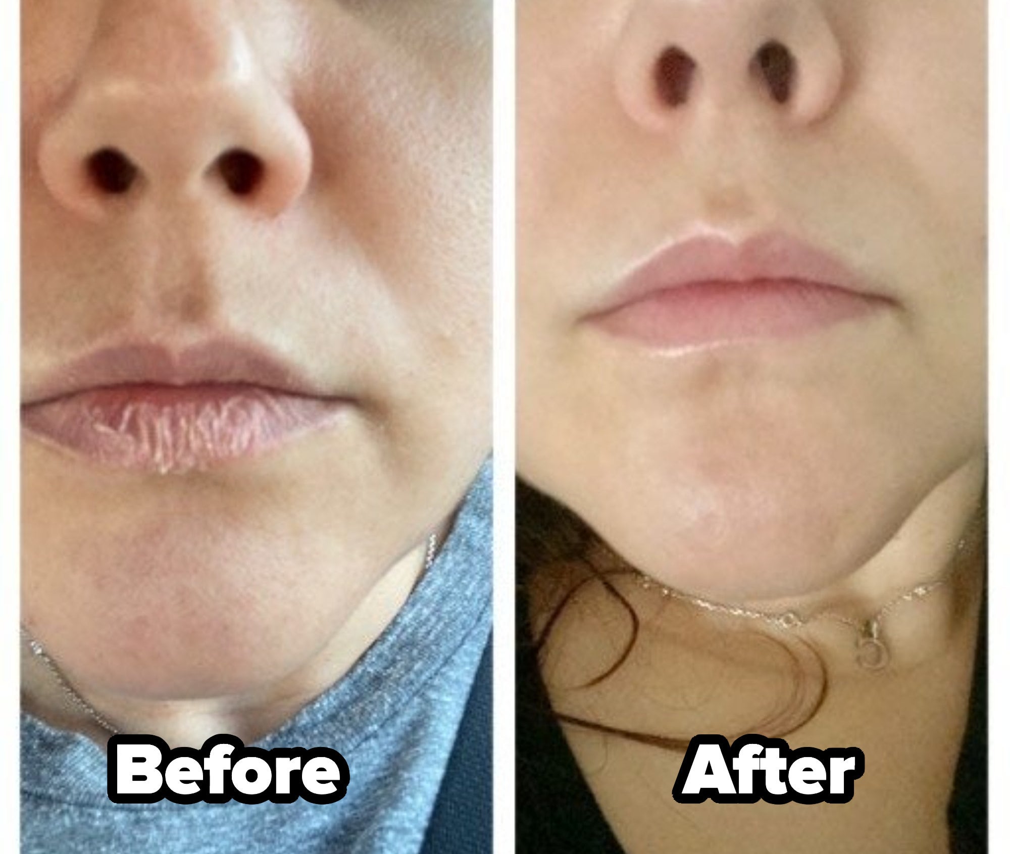 a split image of a reviewer&#x27;s lips before and after using the balm