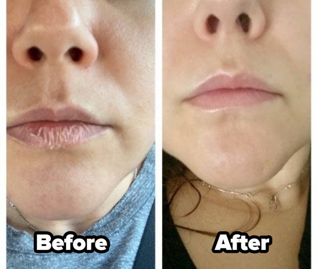 a split image of a reviewer's lips before and after using the balm
