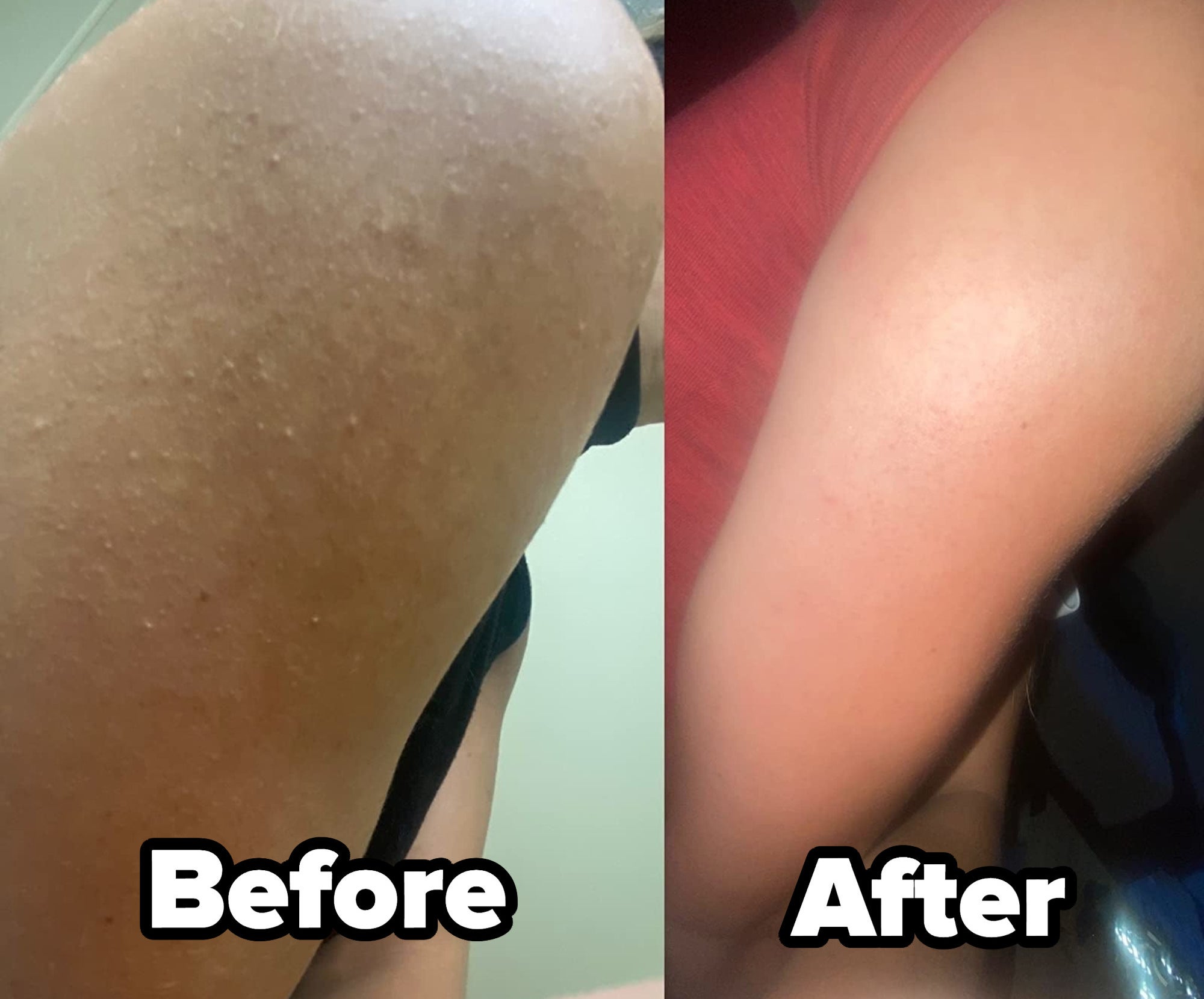 a split reviewer photo of their arm before and after using the body scrub