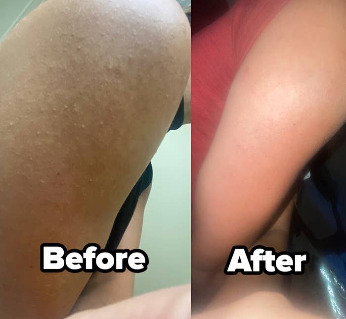 miracle' $24.99 anti-cellulite lotion firms the skin, smoothes bumps and  delivers hydration