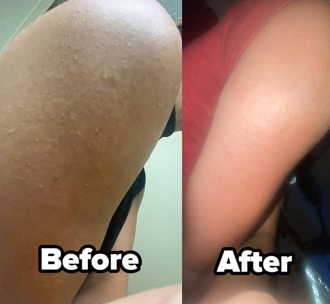 a split reviewer photo of their arm before and after using the body scrub