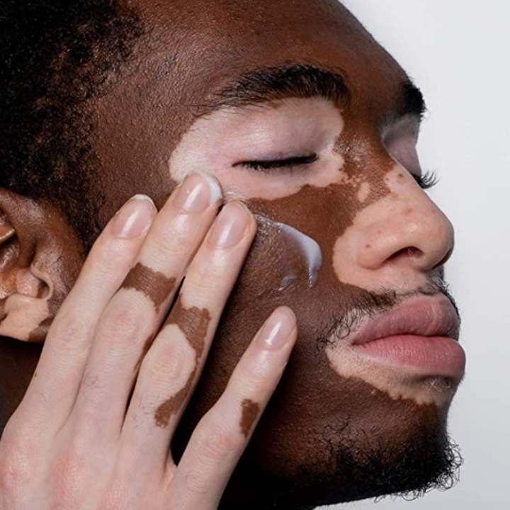 model applying moisture cream to skin
