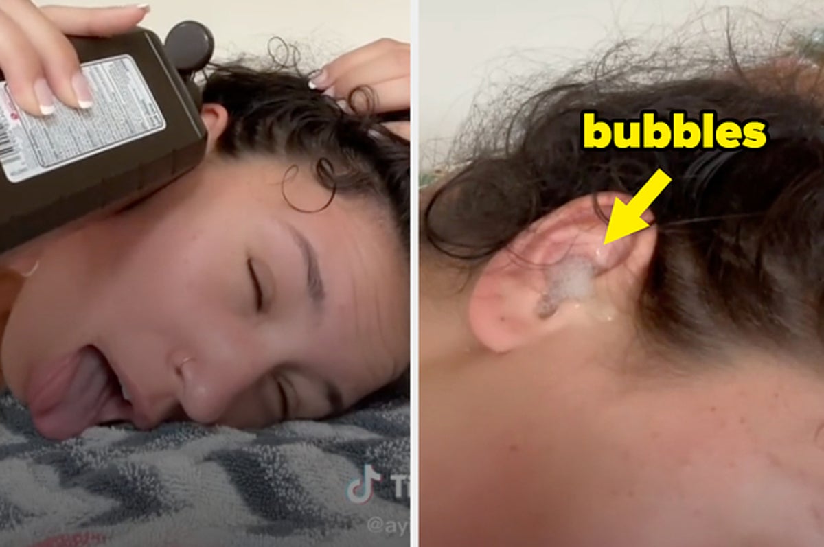 Hydrogen Peroxide Ear Cleaning Is Actually Recommended