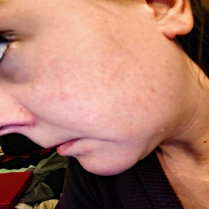 Reviewer after using Vanicream Gentle Facial Cleanser