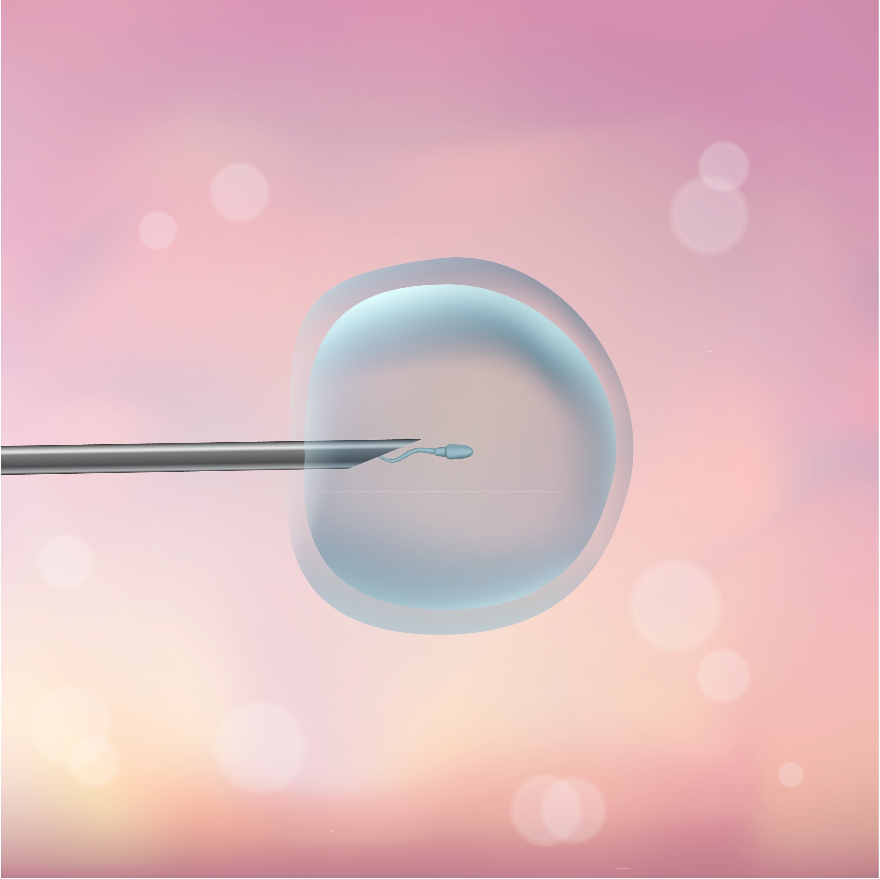 A drawn image of the IVF process internally