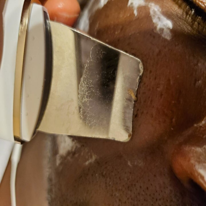 Reviewer scraping face with product