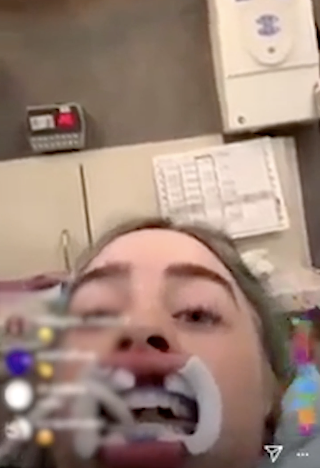 Billie Elish at the dentist as a dental assistant works on her teeth