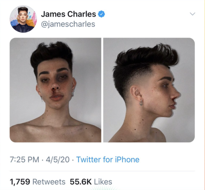 Two faux mugshots of James with a bloodied nose (full-on and side profile), hair perfect