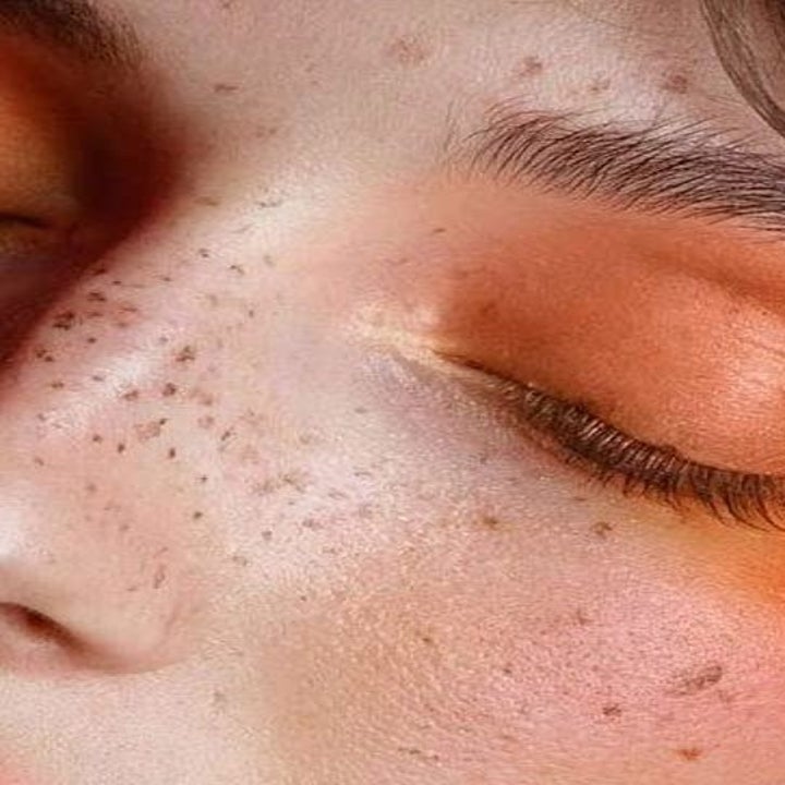 A person with faux freckles on their face