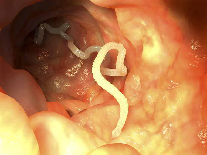 image of intestinal worms