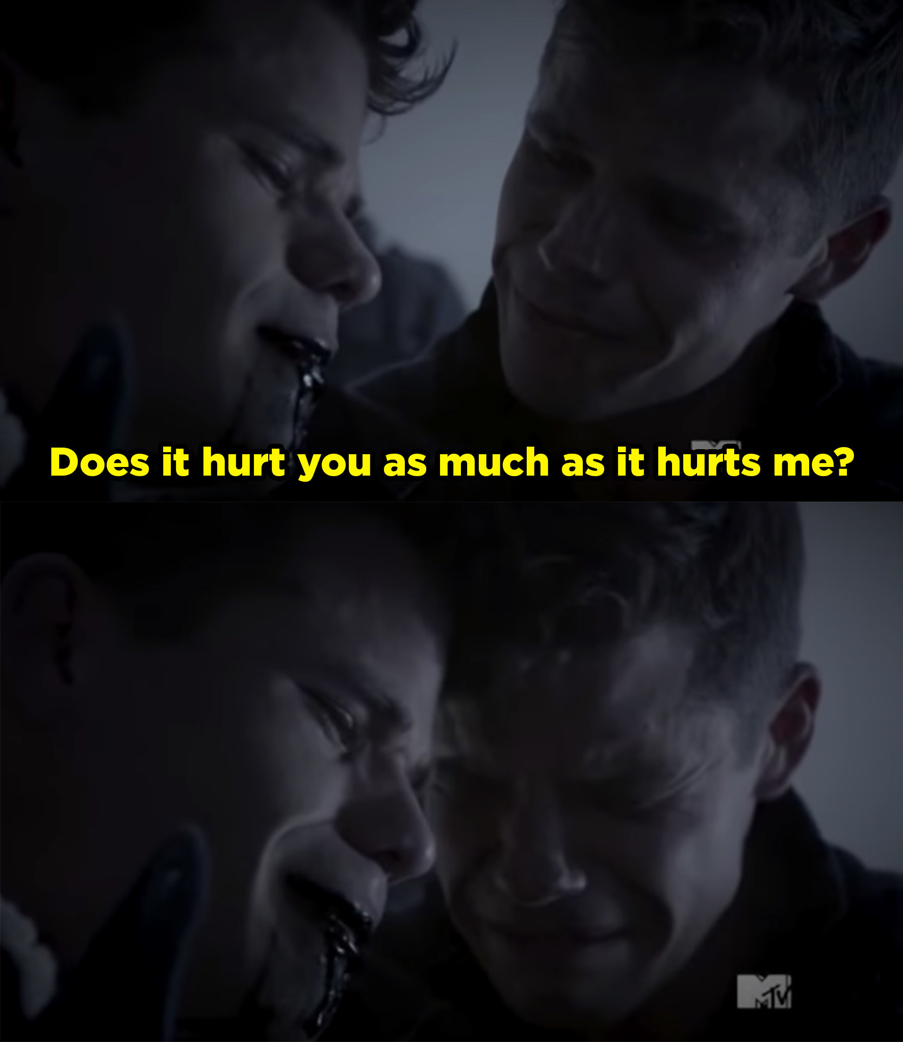 Aiden is crying and bleeding from his mouth. His twin brother Ethan is holding him crying, and Aiden says, &quot;Does this hurt you as much as it hurts me?&quot;