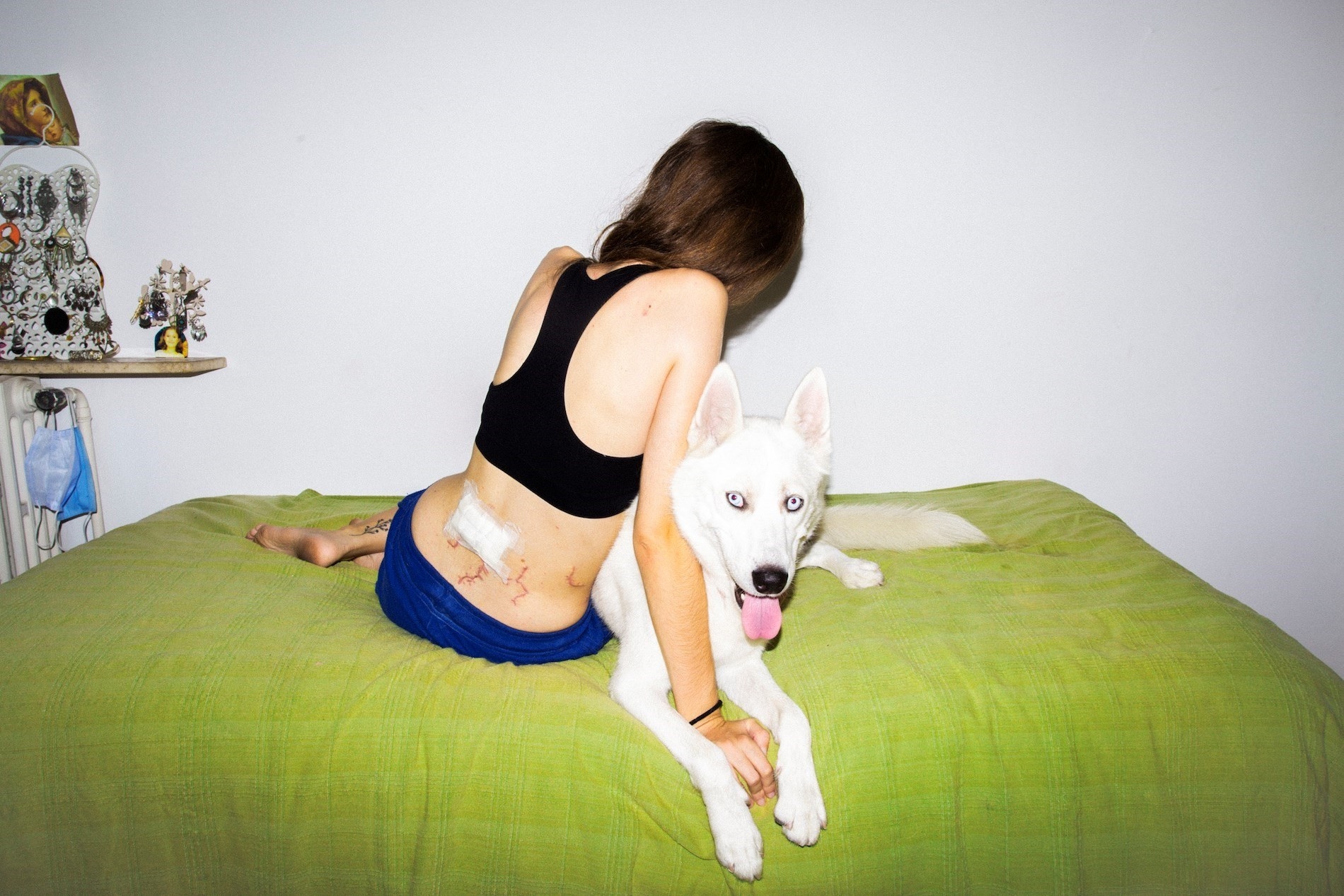 A woman sits with her dog on a bed; she is turned away from the camera and shows injuries and a bandage on her bare back