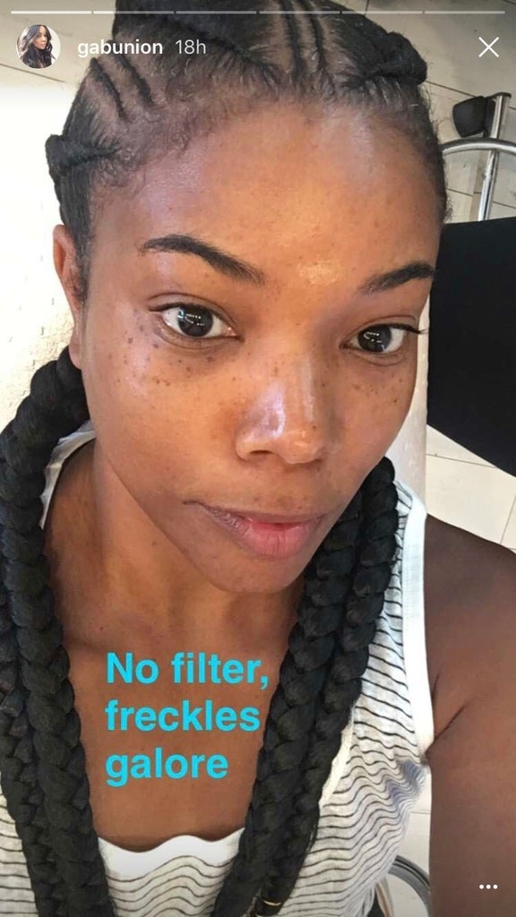 A screenshot from her IG story with the caption &quot;No filter, freckles galore&quot;