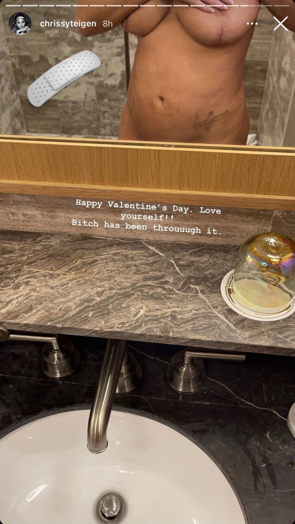 A screen shot of Chrissy&#x27;s Instagram story showing the reflection of her body in the mirror at the bathroom sink, showing an abdominal scar and an incision scar on a breast