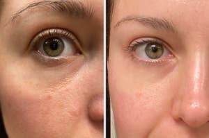 Side by side of eye skin before and after four weeks