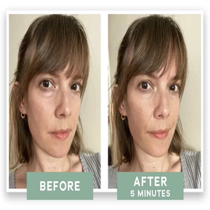 before and after customer using eye cream