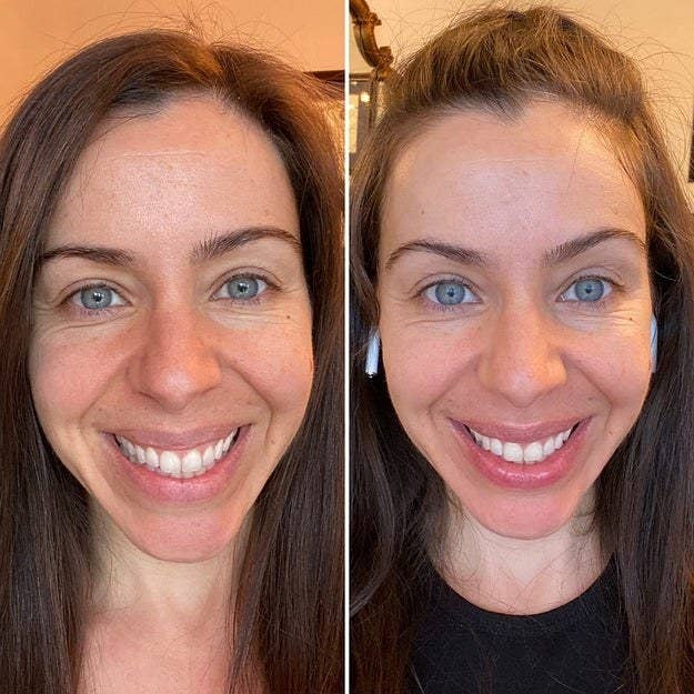 Reviewer showing results of using L'Oreal hyaluronic acid serum with plumper, brighter skin after