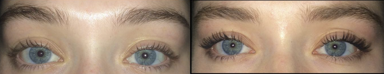 A reviewer&#x27;s lashes before using the mascara / A reviewer&#x27;s fuller lashes after using the mascara