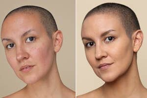 A model with light skin wearing foundation that covered redness