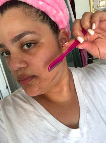 pic of reviewer using a pink dermaplaning tool to remove baby hairs from their face