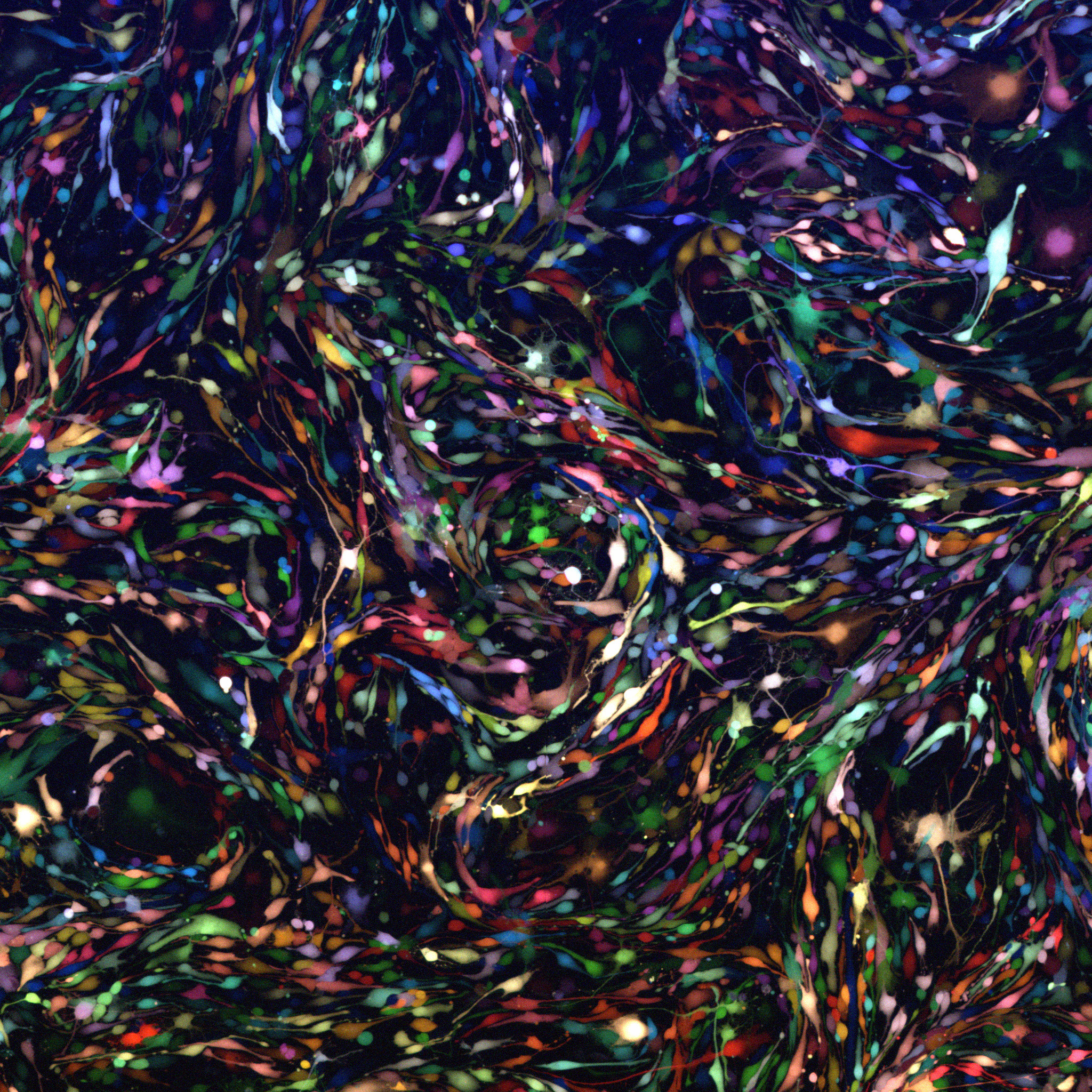 A swirl of colors on a black background which is actually brain tumor cells, magnified many times