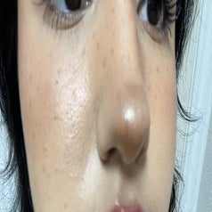 reviewer's face, shiny and oily
