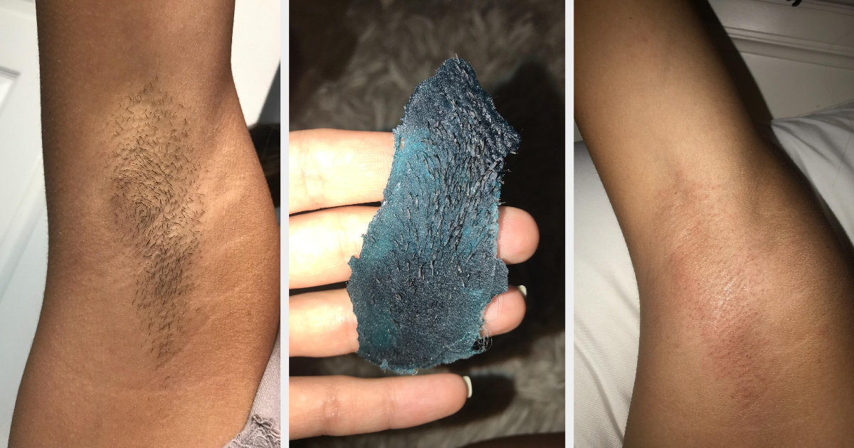 A before image of a reviewer&#x27;s underarm hair, then a picture of the blue wax with hair of it, and an after image of the reviewer&#x27;s hairless underarms