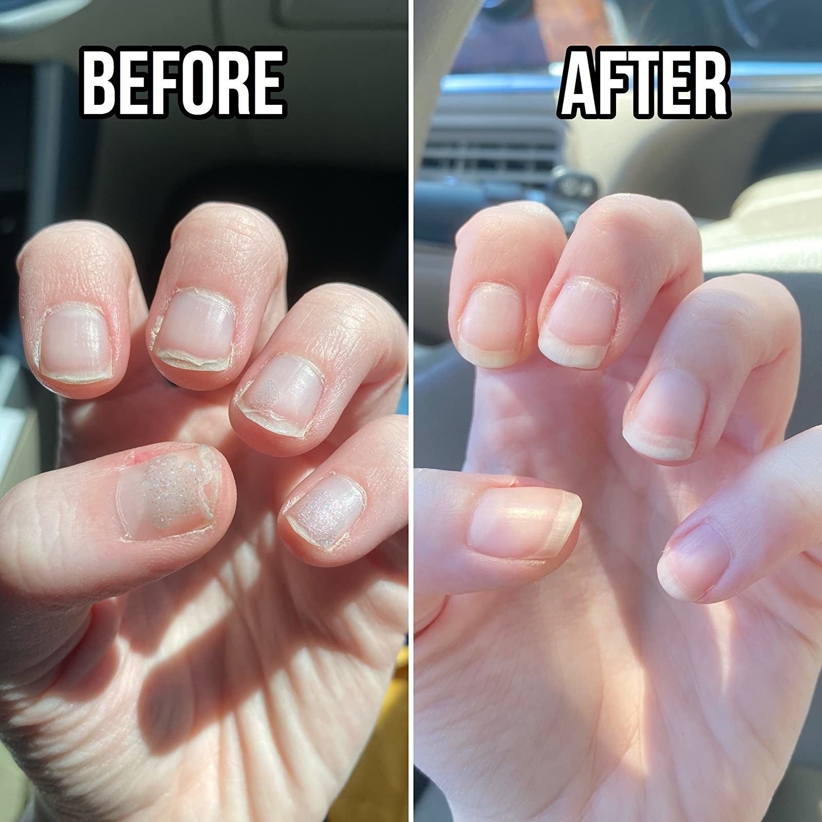 A reviewer&#x27;s peeling nails on the left, the same hand with strong, non peeling or breaking nails on the right
