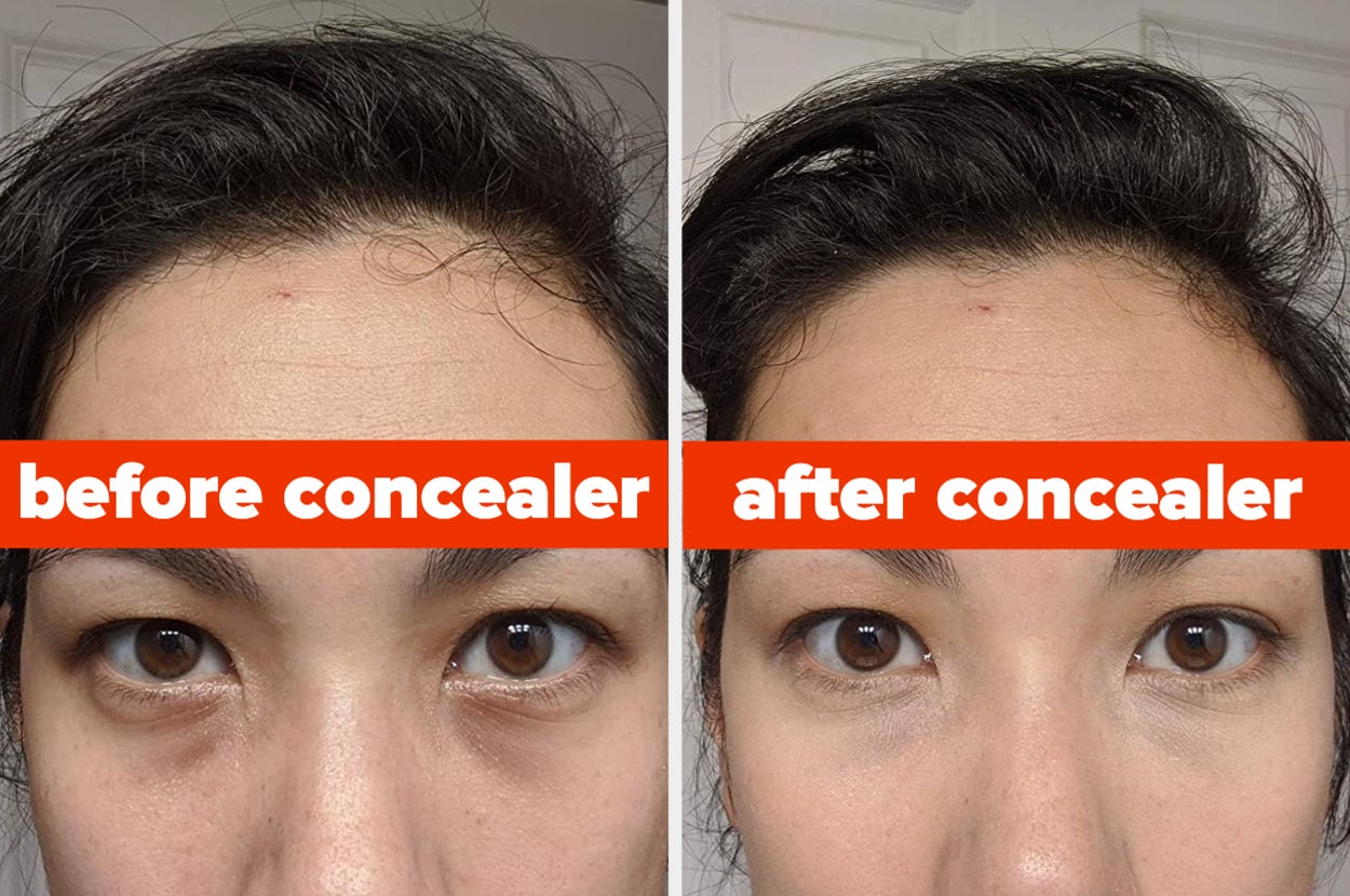 L: reviewer with dark under-eye circles R: the same reviewer after applying concealer and their under eyes look brighter