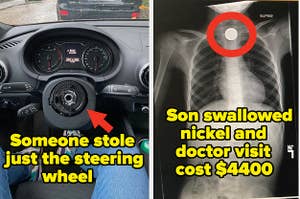 A car with a missing steering wheel that someone stole and an X-Ray of a child with a nickel in their throat