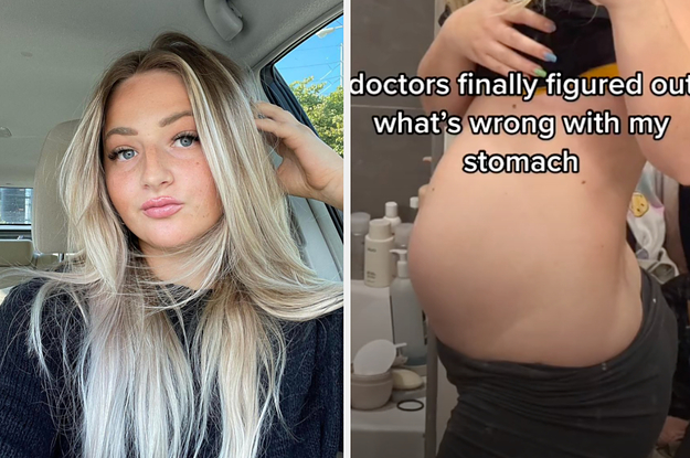 This Woman's Story Of How She Gained 50 Pounds In Three Months And Was Told By A Doctor That Her Bloating Was "Psychosomatic" Has Gone Viral On TikTok
