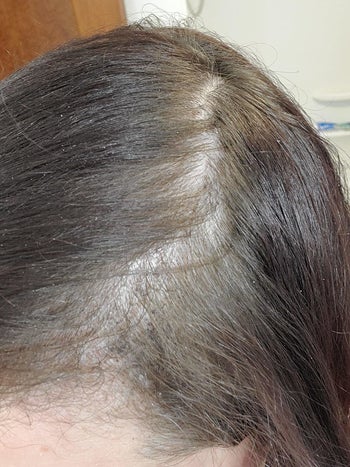 reviewer before showing a thinning hairline