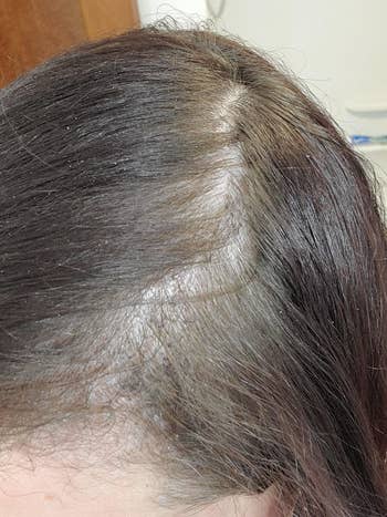 reviewer before showing a thinning hairline