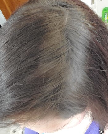 same reviewer after using the powder with scalp completely filled in