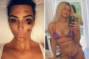 Kim Kardashian showing her psoriasis and Selena Gomez posting an unretouched selfie of herself in a bikini