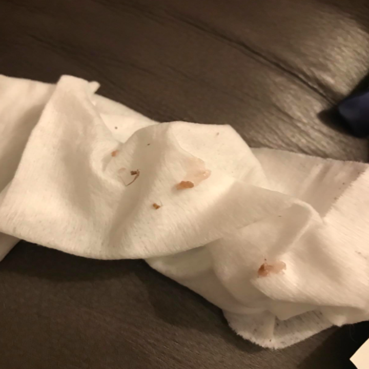 boogers on napkin