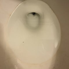 before photo of a dirty toilet with hard water ring and stains
