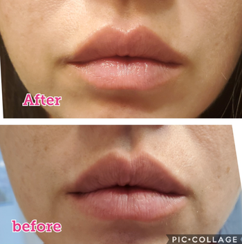 reviewers lips before, looking rough, and after, looking much smoother
